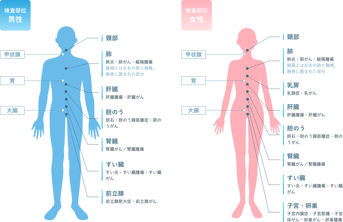 【検査部位 男性】脳 ※：脳梗塞・脳腫瘍・脳動脈瘤・脳血管きょうさく、頸部、肺：肺炎・肺がん・縦隔腫瘍（縦隔とは左右の肺と胸椎、胸骨に囲まれた部分）、肝臓：肝臓腫瘍・肝臓がん、胆のう：胆石・胆のう腺筋腫症・胆のうがん、腎臓：腎臓がん／腎臓腫瘍、すい臓：すい炎・すい臓腫瘍・すい臓がん、前立腺：前立腺肥大症・前立腺がん 【検査部位 女性】脳 ※：脳梗塞・脳腫瘍・脳動脈瘤・脳血管きょうさく、頸部、肺：肺炎・肺がん・縦隔腫瘍（縦隔とは左右の肺と胸椎、胸骨に囲まれた部分）、乳房：乳腺症・乳がん、肝臓：肝臓腫瘍・肝臓がん、胆のう：胆石・胆のう腺筋腫症・胆のうがん、腎臓：腎臓がん／腎臓腫瘍、すい臓：すい炎・すい臓腫瘍・すい臓がん、子宮・卵巣：子宮内膜症・子宮筋腫・子宮体がん・卵巣がん・卵巣腫瘍